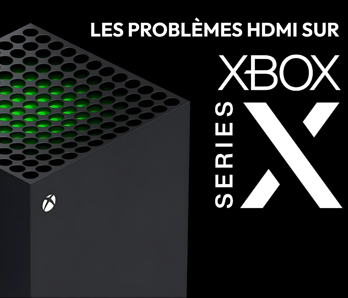Problèmes HDMI sur Xbox Series X : Causes et solutions